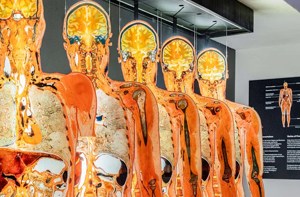 Kurzurlaub Bad Schönborn für 2 (2 Nächte) inkl. Körperwelten Heidelberg