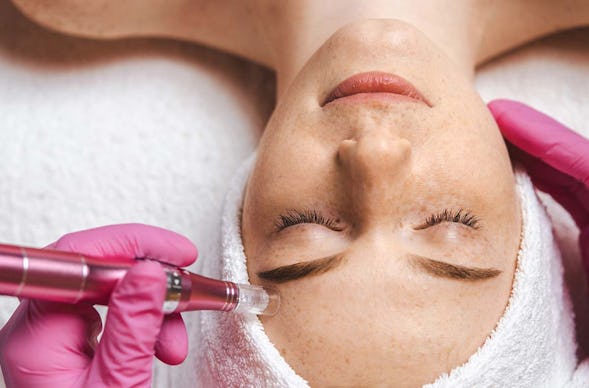 Microneedling Stuttgart
